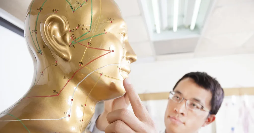 Acupuncture vs. Acupressure: Exploring Two Paths to Holistic Healing 1 Acupuncture and Acupressure points on the head of a mannequin.